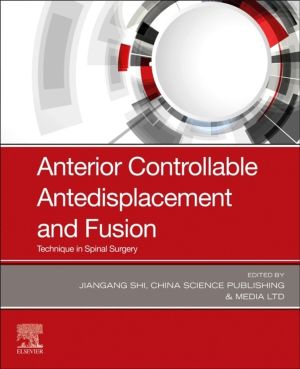 Anterior Controllable Antedisplacement and Fusion - Technique in Spinal Sur
