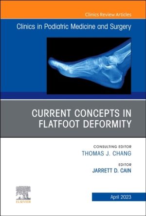 Current Concepts in Flatfoot Deformity, An Issue of Clinics in Podiatric Me
