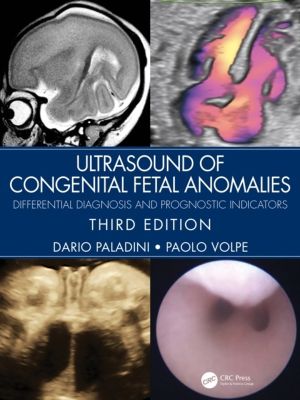 Ultrasound of Congenital Fetal Anomalies - Differential Diagnosis and Progn