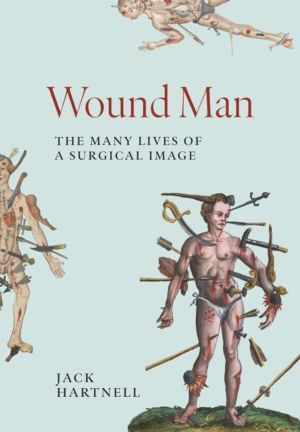 Wound Man - The Many Lives of a Surgical Image