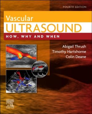 Vascular Ultrasound - How, Why and When