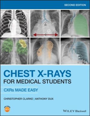 Chest X-Rays for Medical Students - CXRs Made Easy