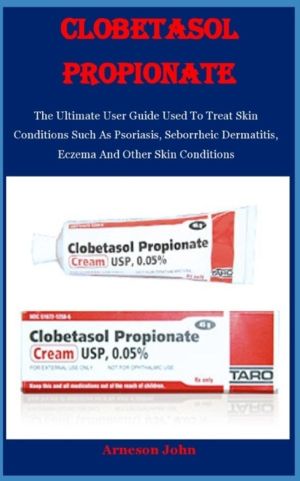 Clobetasol Propionate - The Ultimate User Guide Used To Treat Skin Conditio