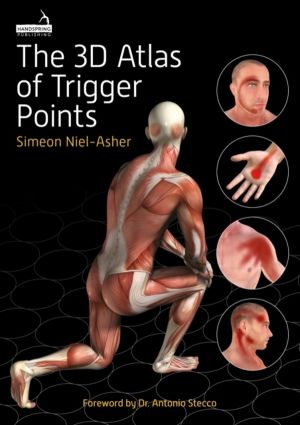 3D Atlas of Trigger Points
