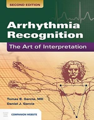 Arrhythmia Recognition: the Art of Interpretation - The Art of Interpretati