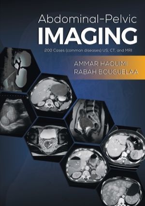 Abdominal-Pelvic Imaging - 200 Cases (Common Diseases): US, CT and MRI