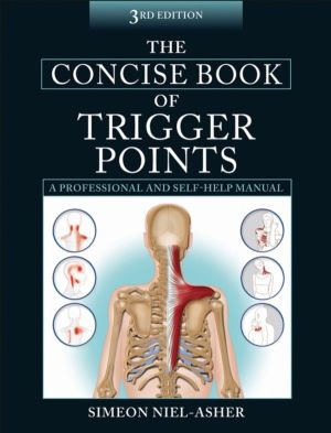 Concise Book of Trigger Points