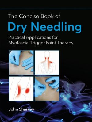 Concise Book of Dry Needling - Practical Applications for Myofascial Trigge