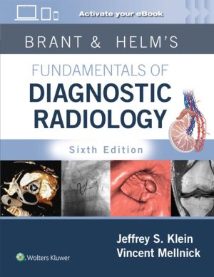 Brant & Helms' Fundamentals of Diagnostic Radiology: Print + eBook with Mul