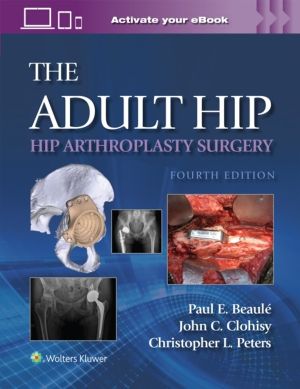 Adult Hip: Hip Arthroplasty Surgery Print + eBook with Multimedia