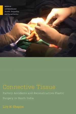 Connective Tissue - Factory Accidents and Reconstructive Plastic Surgery in
