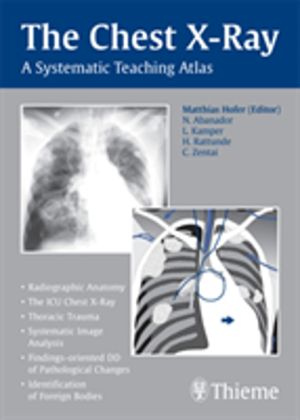 Chest X-Ray - A Systematic Teaching Atlas