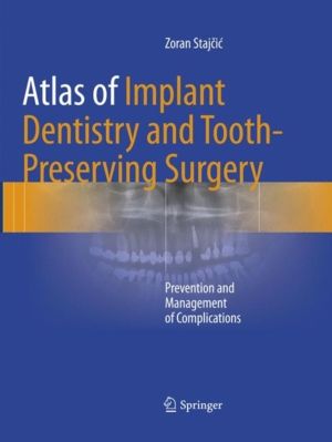 Atlas of Implant Dentistry and Tooth-Preserving Surgery - Prevention and Ma