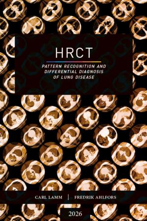 HRCT - Pattern Recognition and Differential Diagnosis of Lung Disease